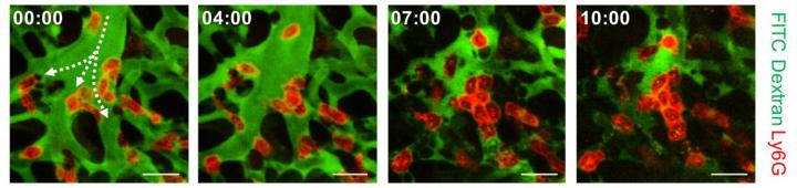 Figure 3. Aggregation of Neutrophils and Consequent Flow Disturbance in Pulmonary Arteriole