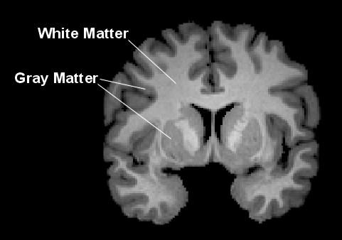 Depiction of Gray and White Matter in the Brain