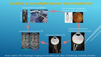 Figure 1: Spaceflight-Induced Visual Impairment