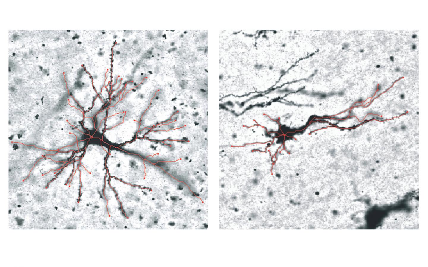 Neuron Differences
