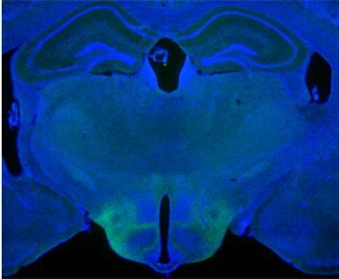 Ventromedial Hypothalamus in Male Mouse Brain