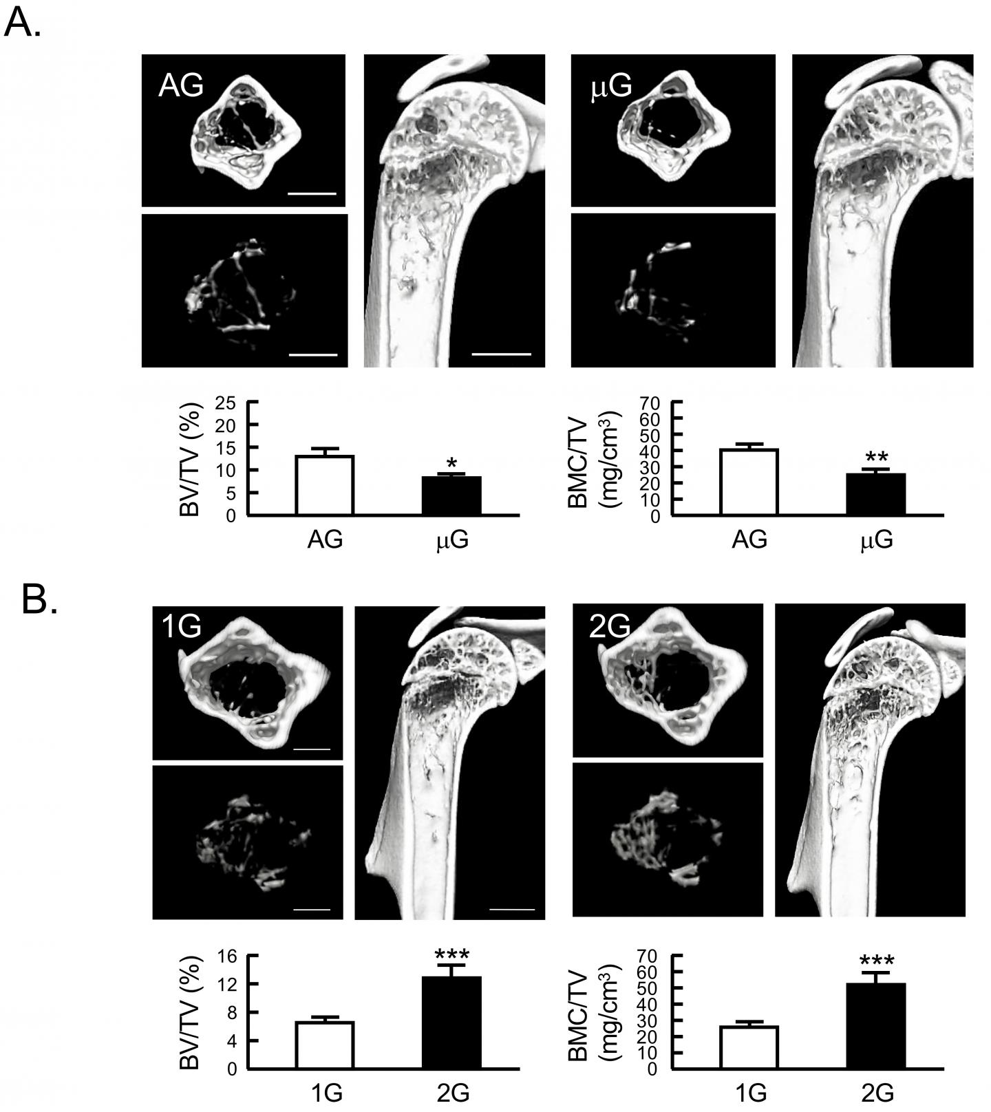 The Effects of Altered Gravity on the Bone Mass of Humerus in Mice