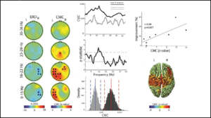 Brain-Robot Therapy Reroutes Motor Pathway in Stroke Patients