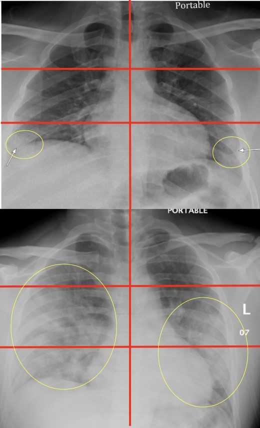 X-Ray Study Images