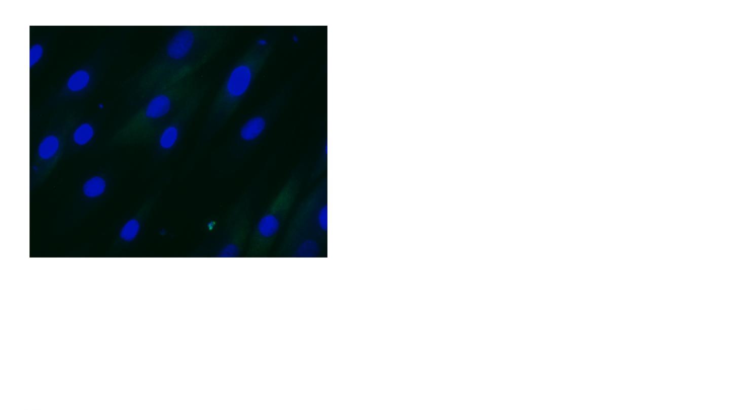 DM1 Cells Kinase Inhibitor Treated 