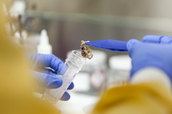 Professor Marino Working on a Brain Tumour Sample