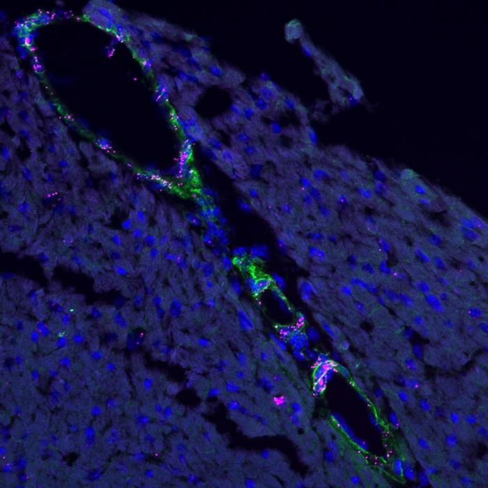 Olfr558 mRNA (stained magenta) is expressed in heart vascular smooth muscle cells