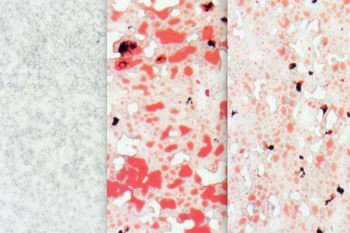 Natural Sugar Defends Against Metabolic Syndrome, in Mice