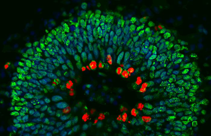 Section through a human brain organoid