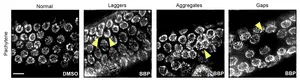 Plastic chemical causes causes DNA breakage and chromosome defects in sex cells