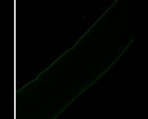 Protein Repairs Cell Damage in Muscle Dystrophy (3 of 3)