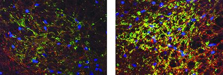 SCI Stem Cells, University of California San Diego