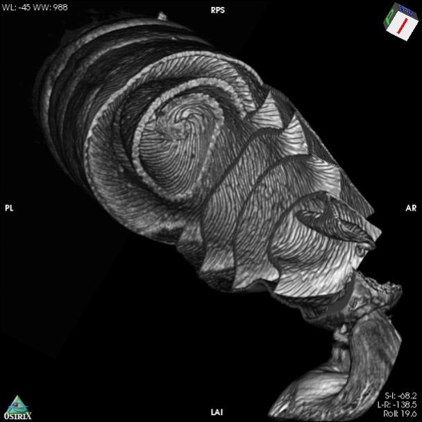 Dogfish spiral intestine