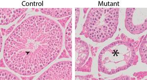 Normal seminiferous tubules in control testes