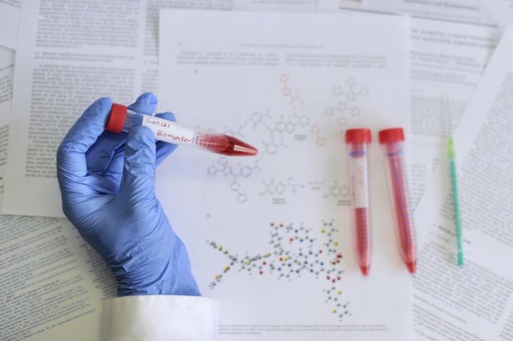 A Special Polymer Film Rrecognizes Molecules of Neopterin