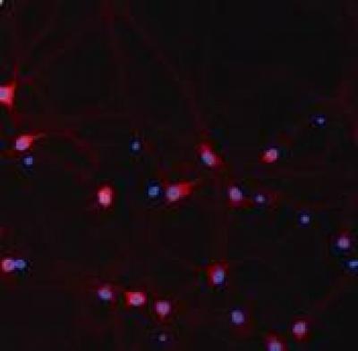 Hippocampal Neurons, Staining 