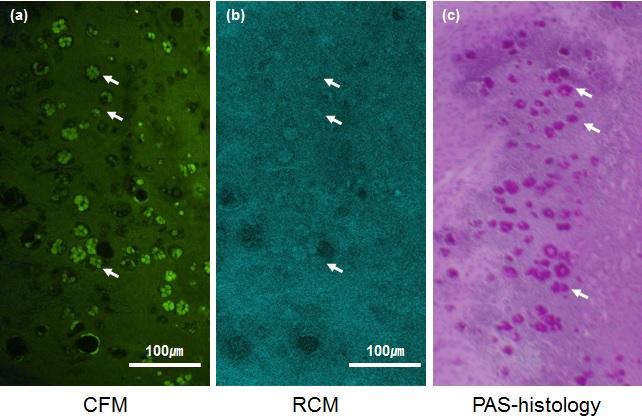 Fluorescence Imaging Demonstration of Conjunctival Goblet Cells (CGCs)