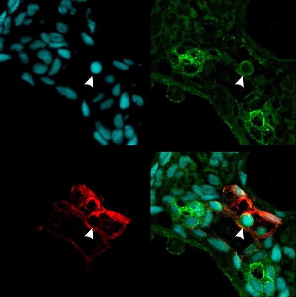 Proinflammatory HSC