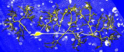 Regenerated Dendrites