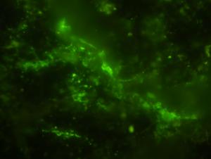 Microbial cells stained green.