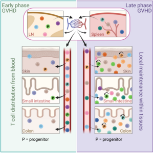 A new model of graft-versus-host-disease (GVHD)