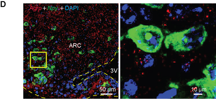 Brain cells that drive appetite in obesity