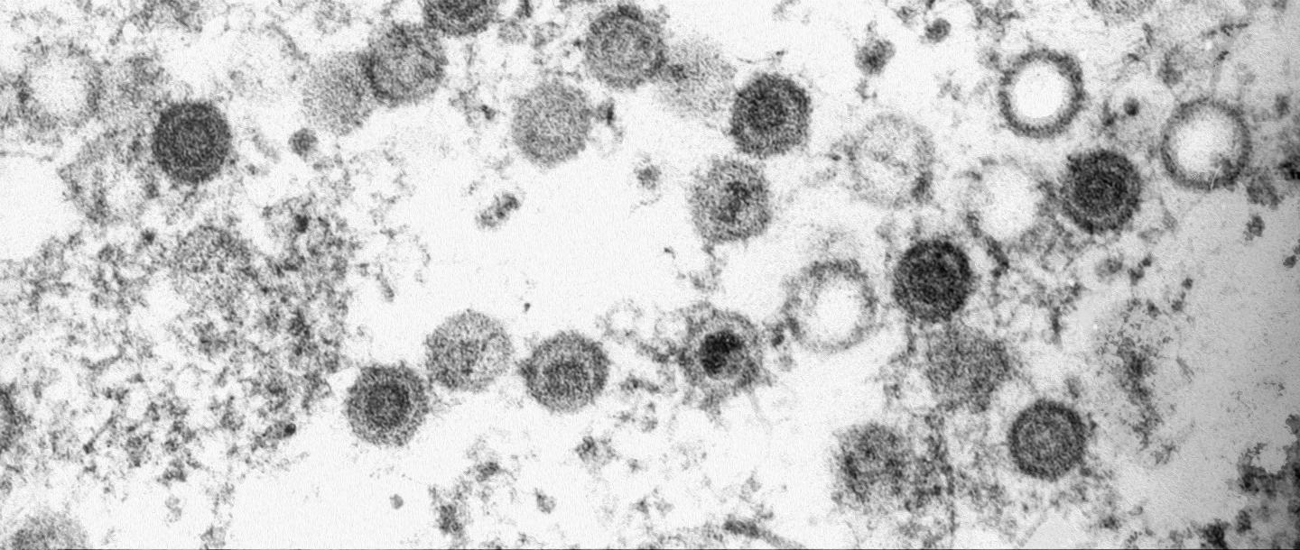 Electron microscopy of MHV-68 virions.