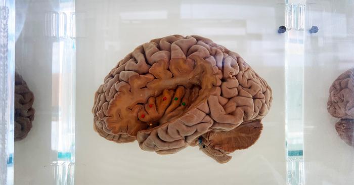 Human brain