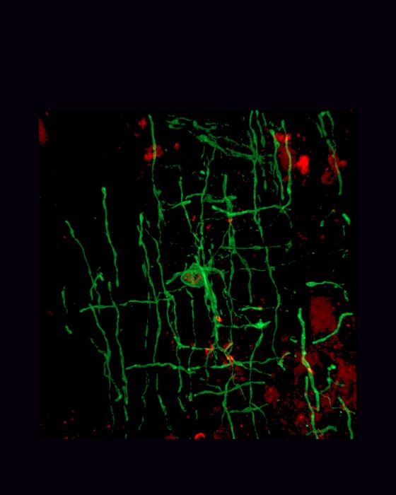 A myelinating oligodendrocyte (green)