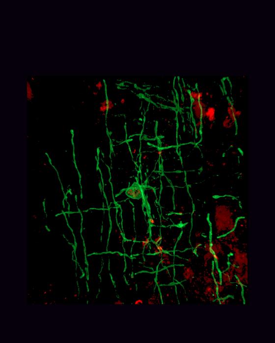 Ancient Retroviruses Played a Key Role in the Evolution of Vertebrate Brains