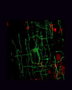 A myelinating oligodendrocyte (green)