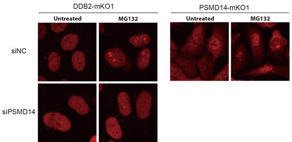 Figure 2: The effects of the proteasome inhibitor (MG132) on the subnuclear localization of DDB2 and proteasome.