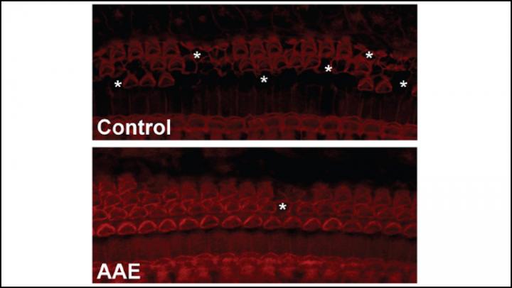 Listening to a Mix of Sounds and Silence Preserves Temporal Sound Processing in Mice with Hearing Loss