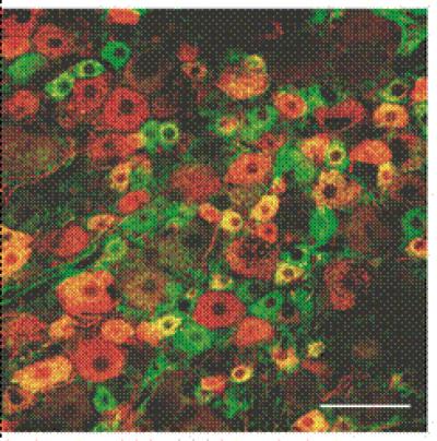 Double Immunofluorescence 