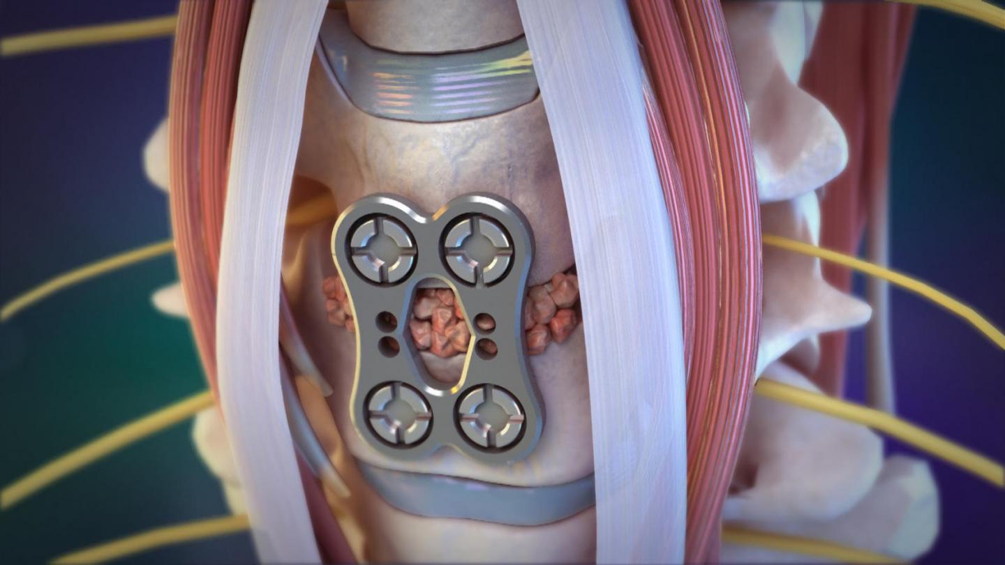 Blausen Medical Library Animation Example