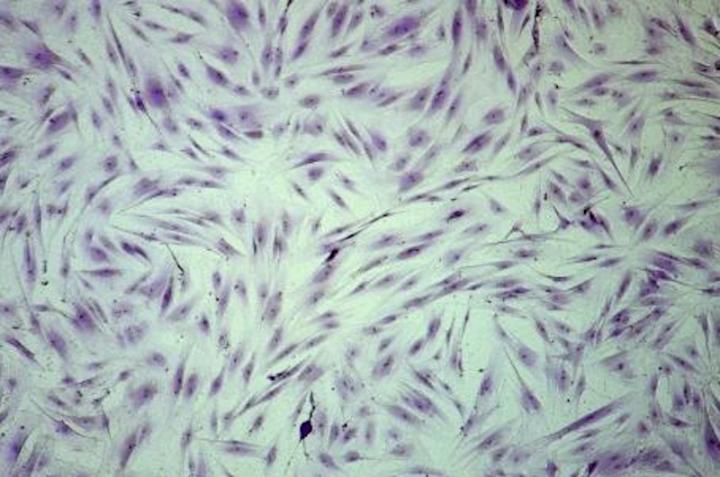 Human Primary Dermal Fibroblasts