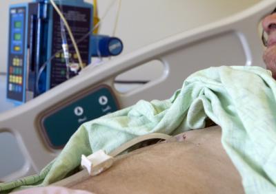 Gastric Feeding Tube