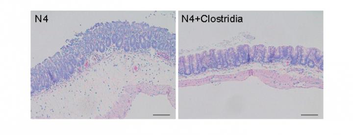 Newborn Mouse Gut Lining With and Without Added Clostridia