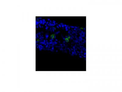 Insulin-producing Cells