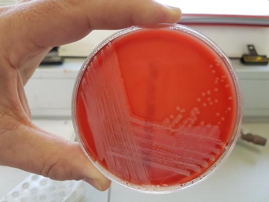 Staphylococcus Cornubiensis