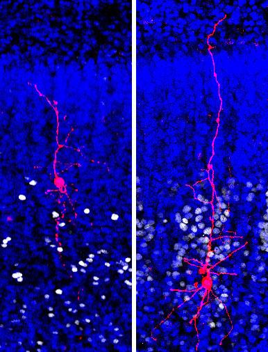 Brain Cell Genomics Reveals Molecular Pathology of Autism (1 of 1)