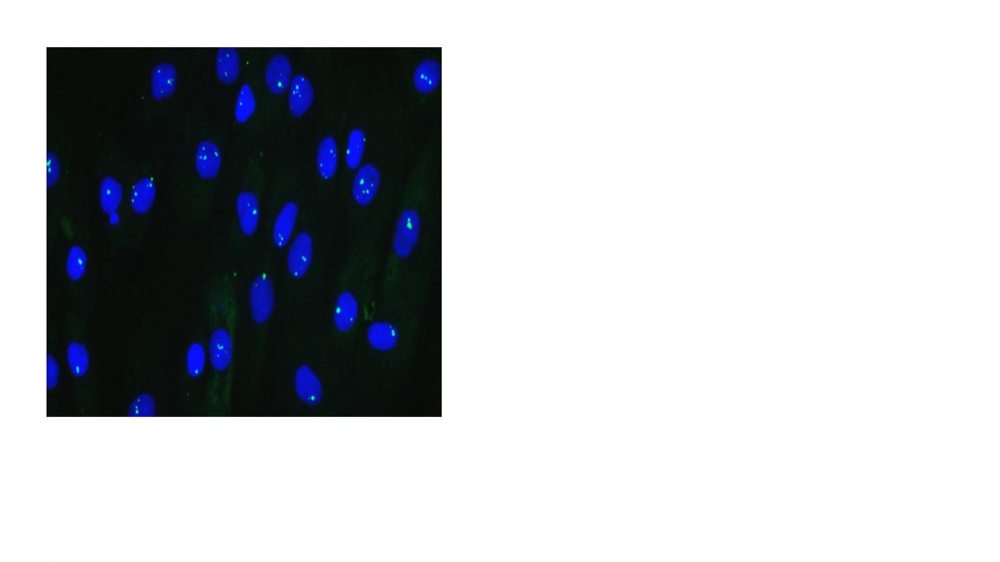 DM1 Cells Untreated 