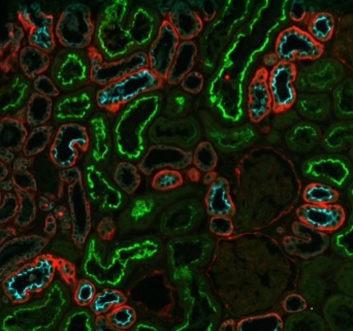 Kidney immunofluorescence staining for the renal injury marker