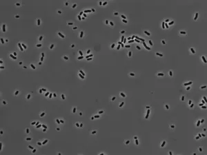 Oral Klebsiella pneumoniae