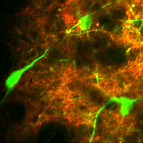 Brain Imaging from Novel Miscroscope