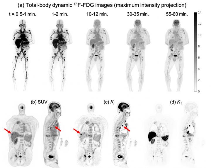 Total-body dynamic 18F-FDG PET imaging with the uEXPLORER scanner