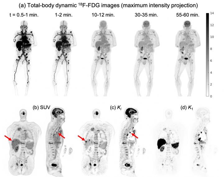 Total body Dynamic 18F FDG PET IMAGE EurekAlert Science News Releases