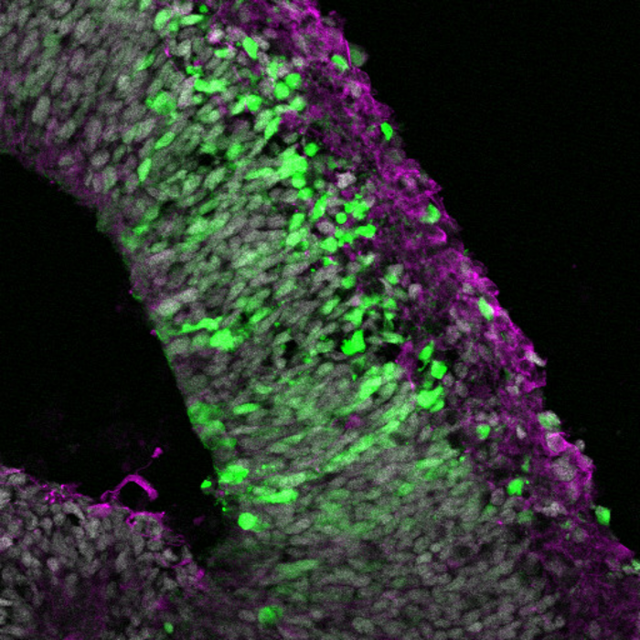 Brain organoid of a commen marmoset