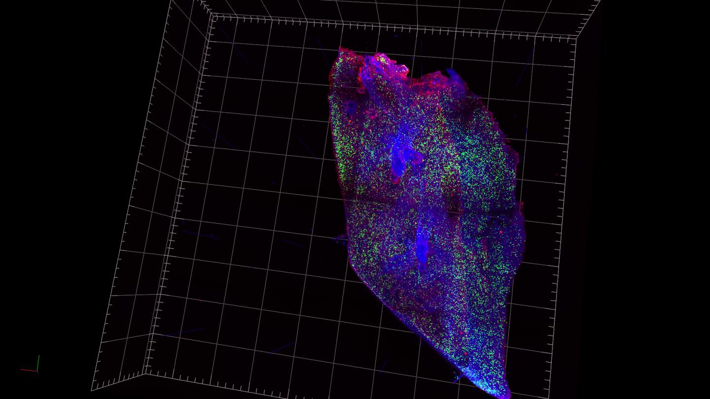 Lightsheet Image of Mouse Lung