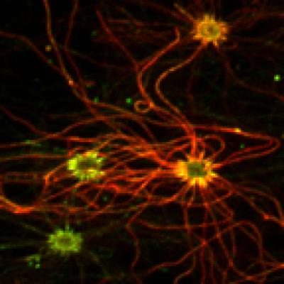 Live Olfactory Sensory Neurons